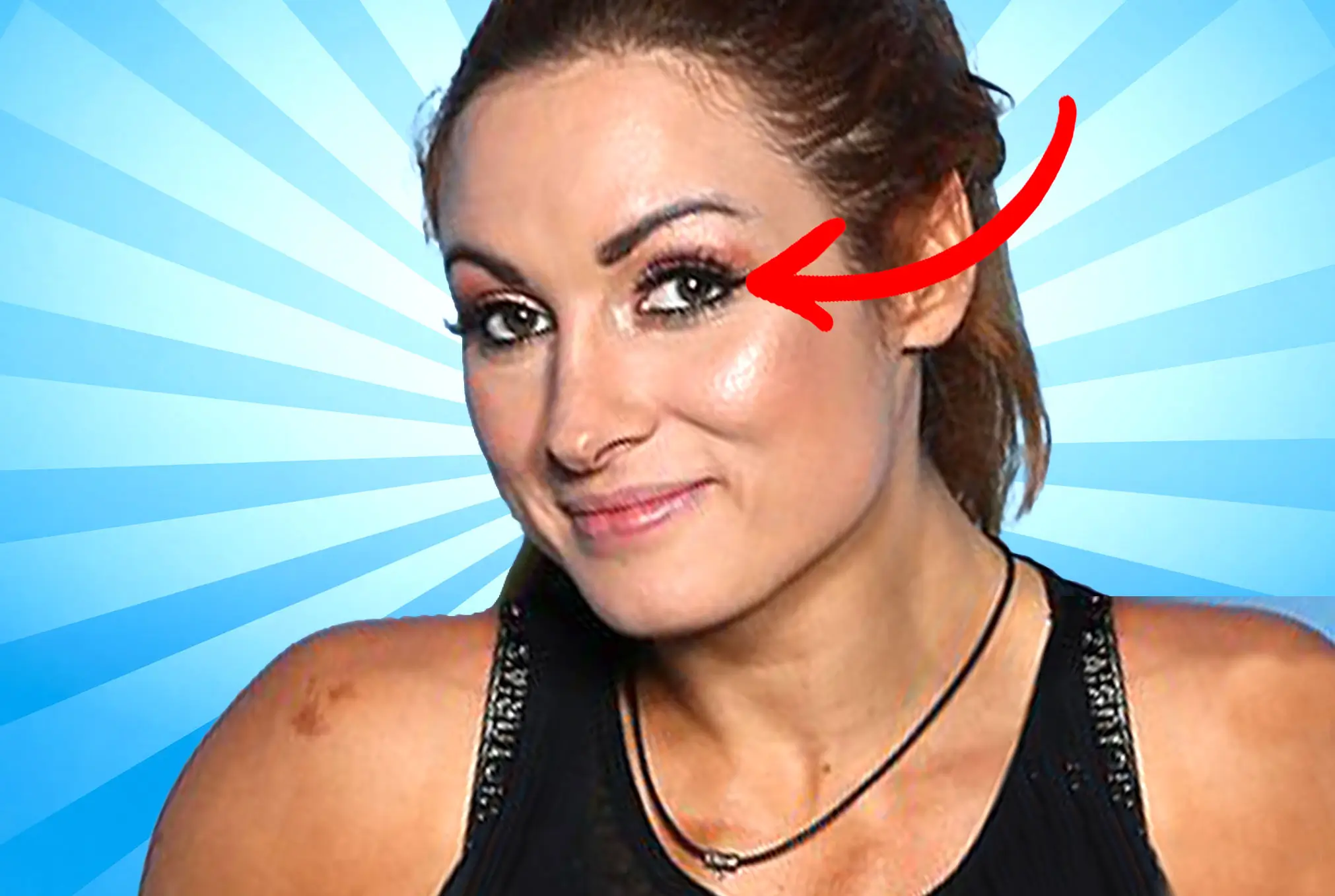 Becky Lynch lazy eye