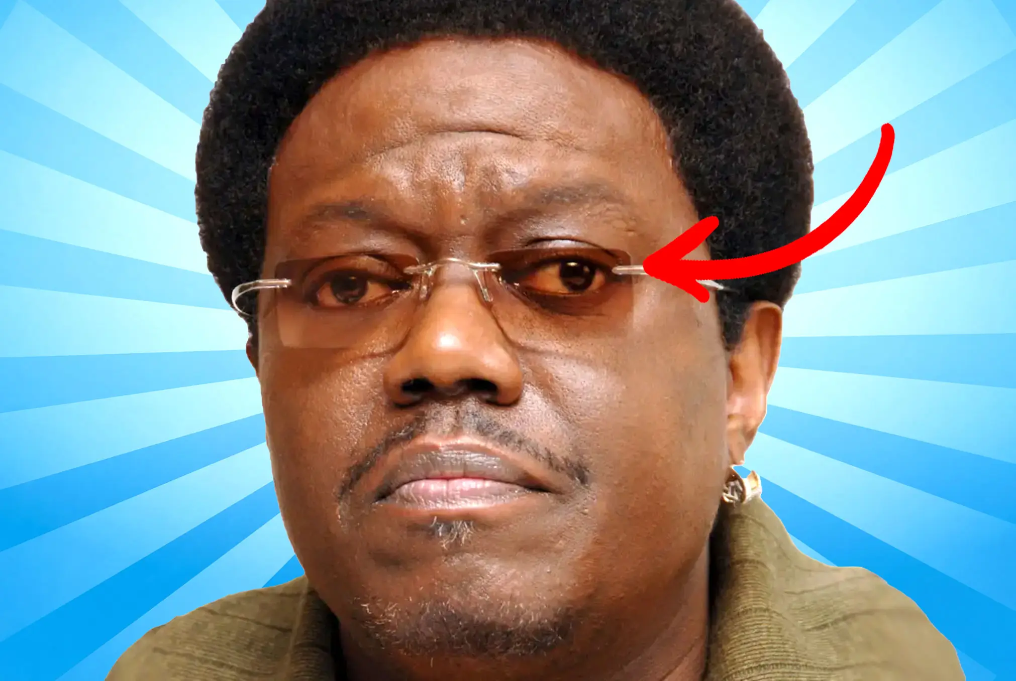 Bernie Mac lazy eye