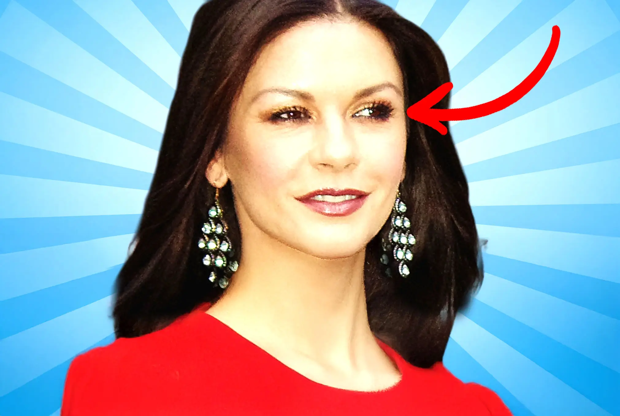 Catherine Zeta-Jones lazy eye