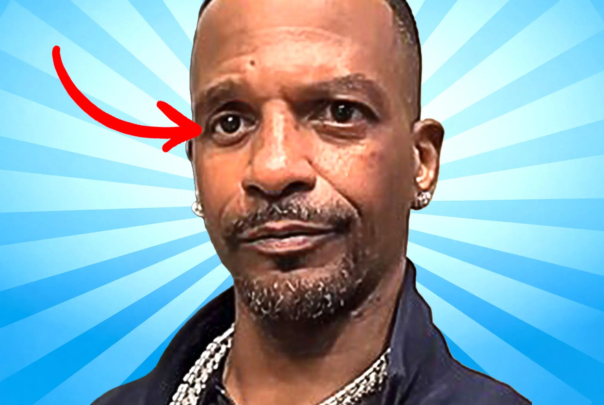 Charleston White lazy eye