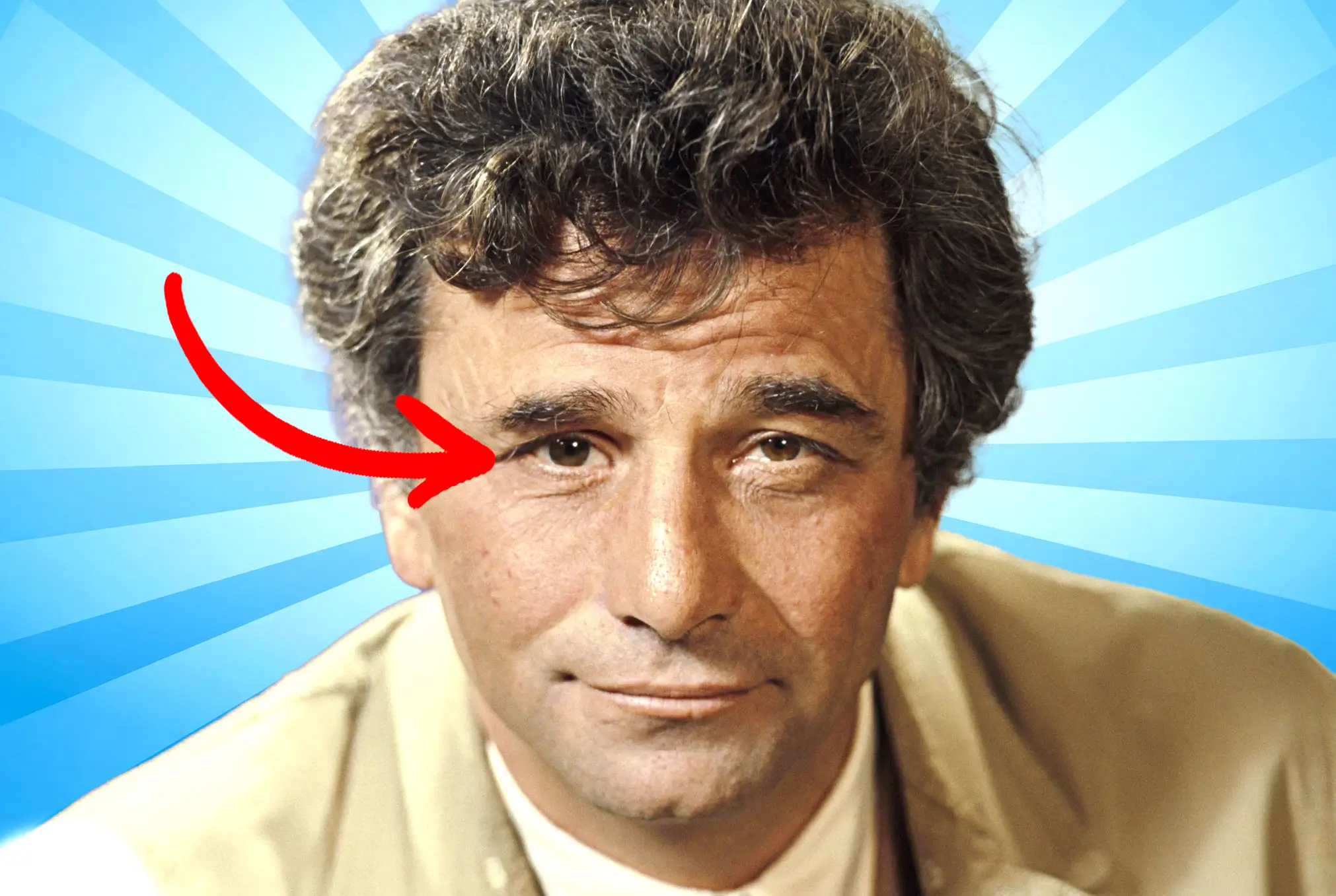 Columbo lazy eye