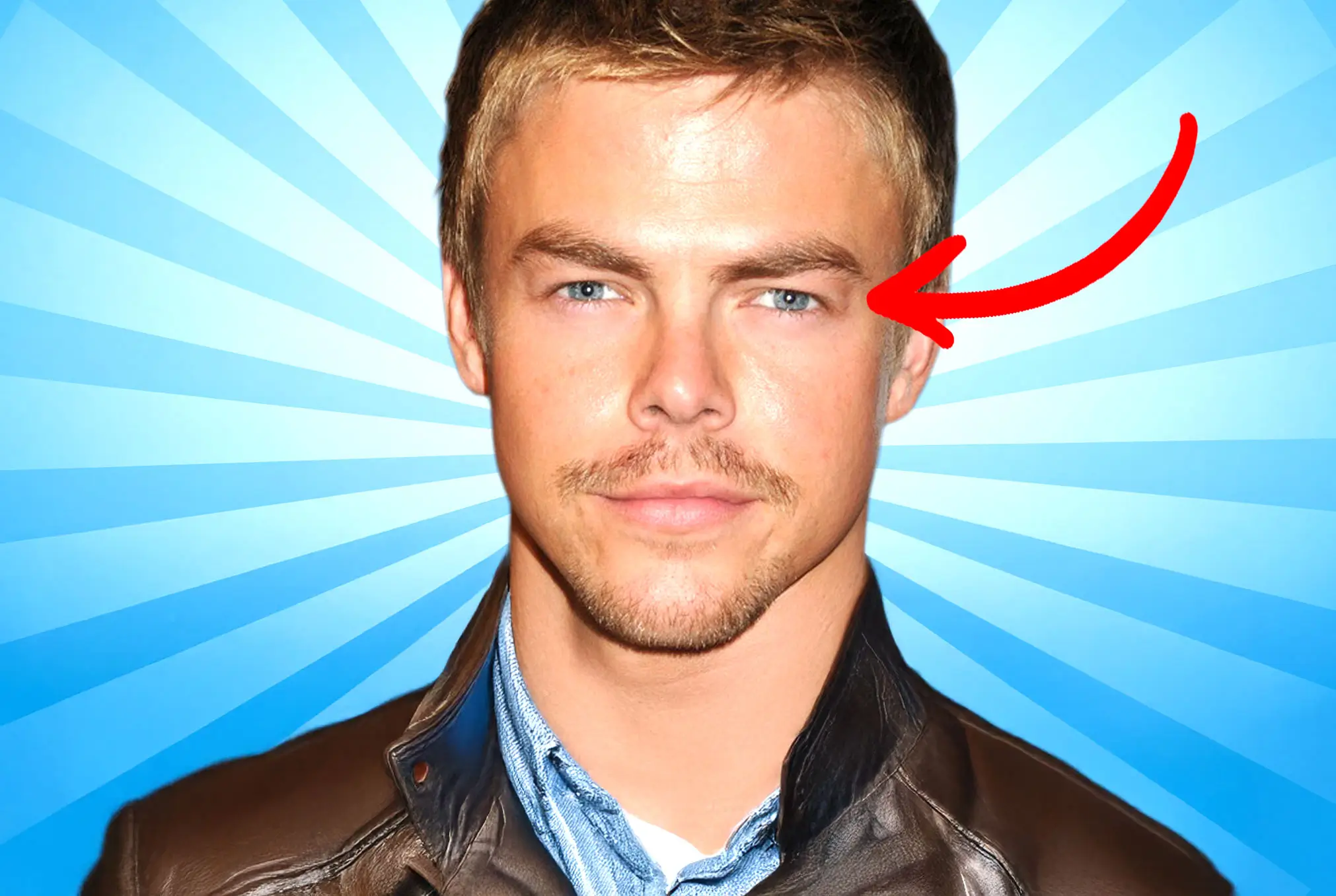 Derek Hough lazy eye
