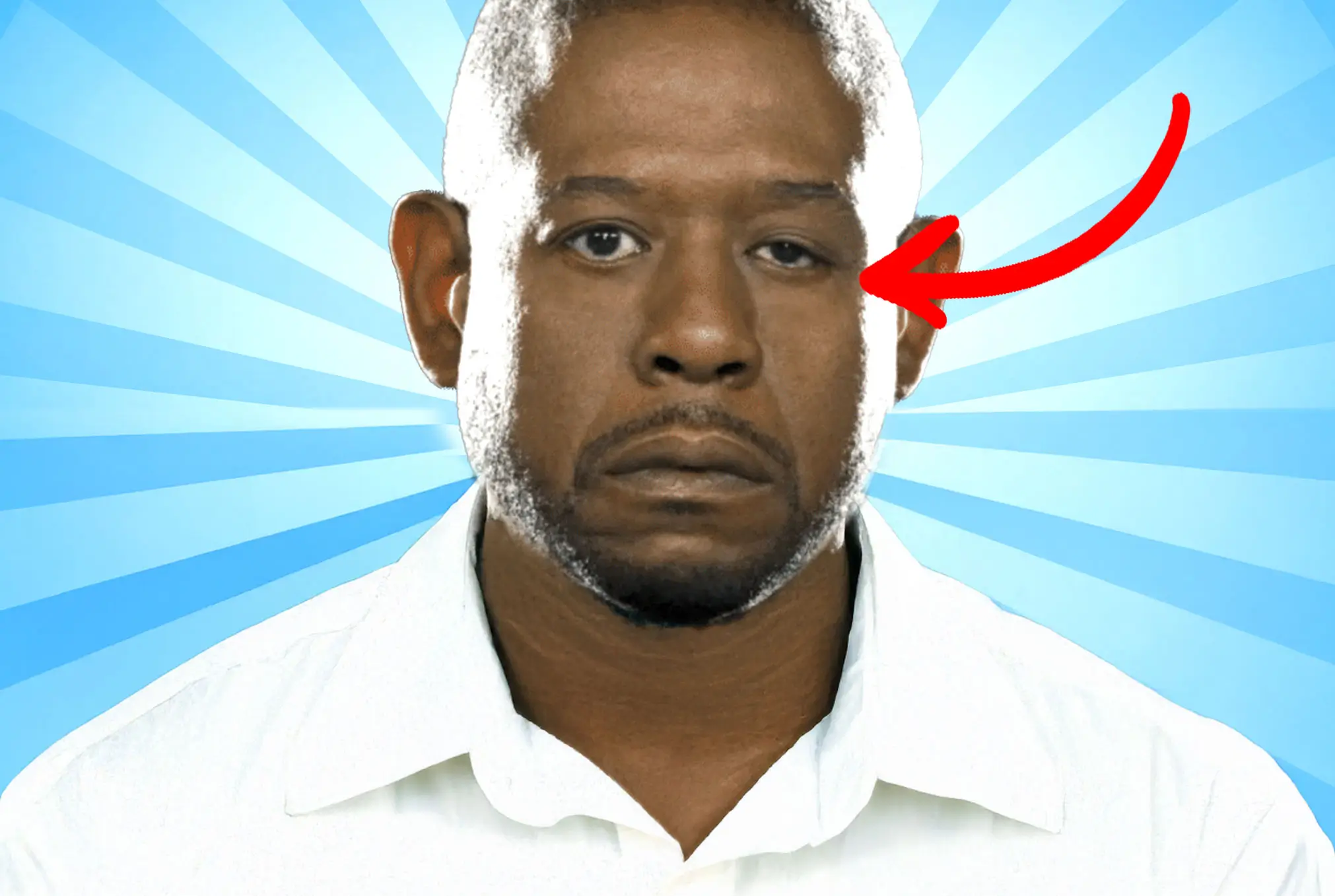 Forest Whitaker lazy eye
