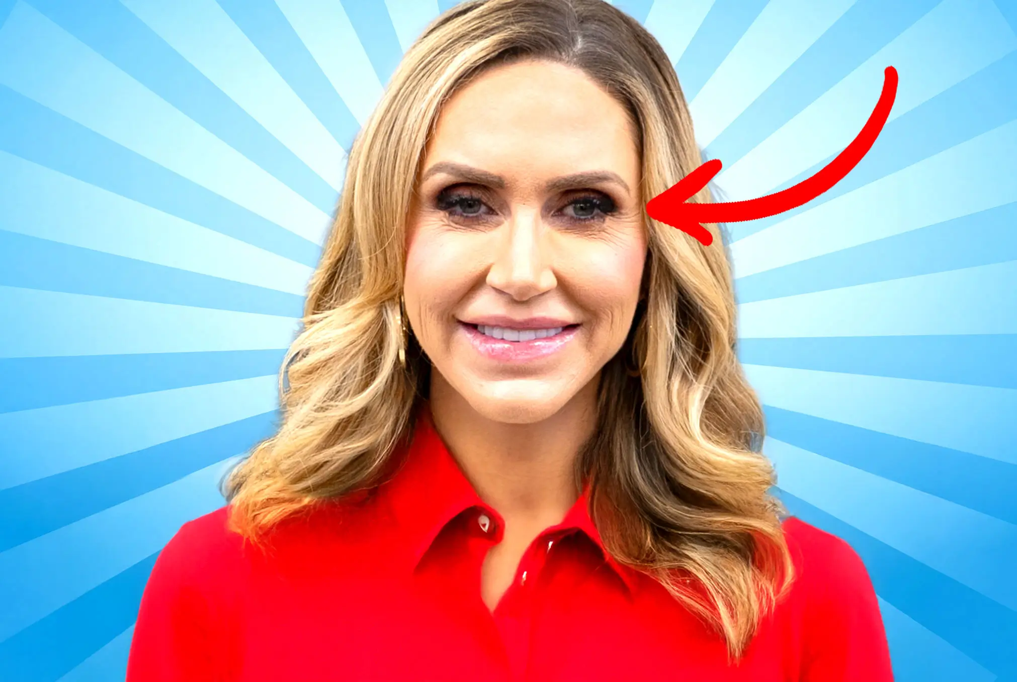 Lara Trump lazy eye