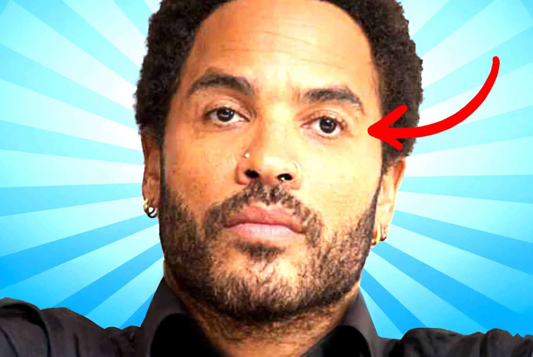 Lenny Kravitz lazy eye