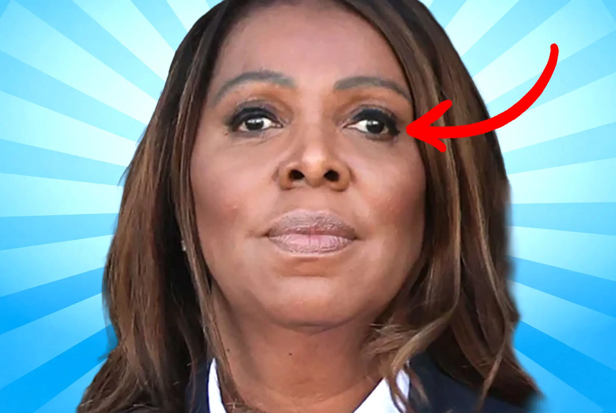 Letitia James lazy eye