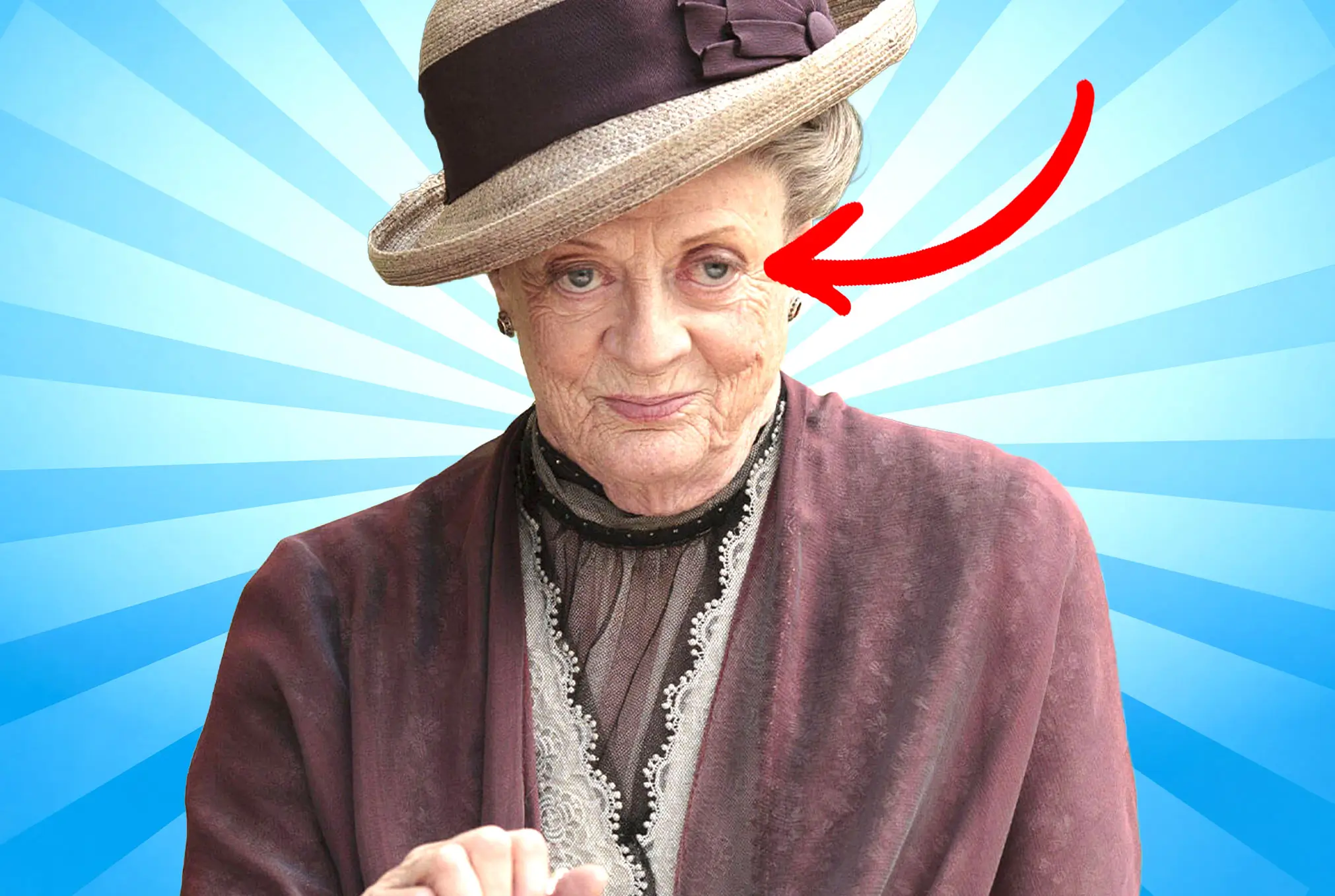 Maggie Smith lazy eye