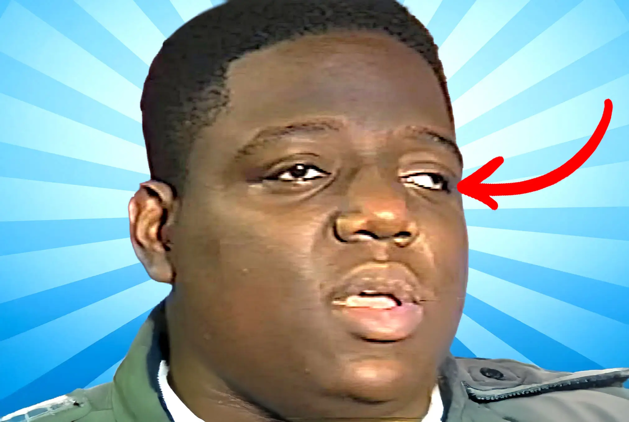 The Notorious B.I.G. lazy eye