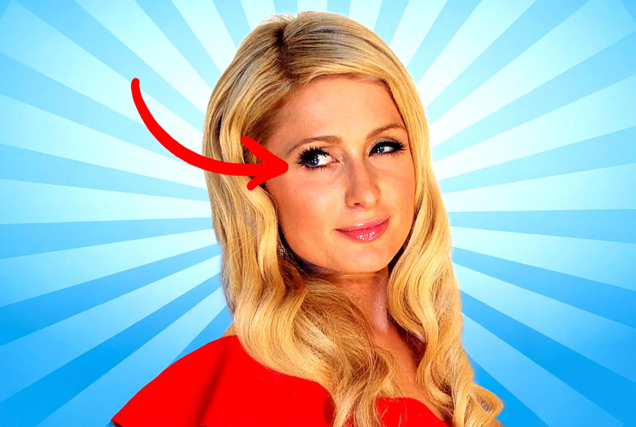 Paris Hilton lazy eye
