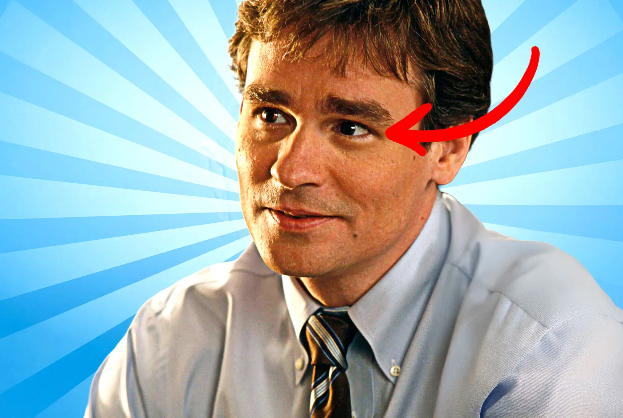 Robert Sean Leonard lazy eye
